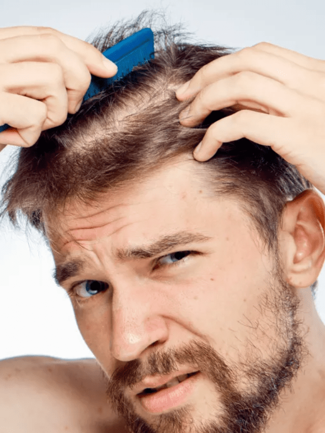 Techniques to stop men’s hair loss