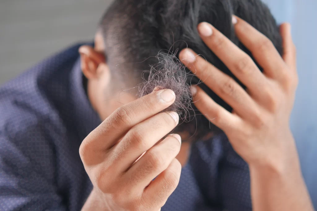 vitamin d hair loss